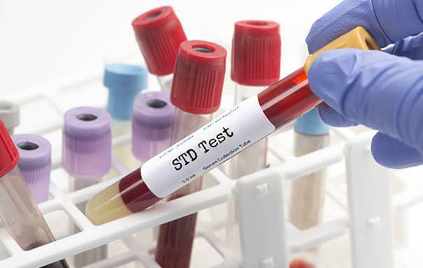 STD test tubes with blood samples